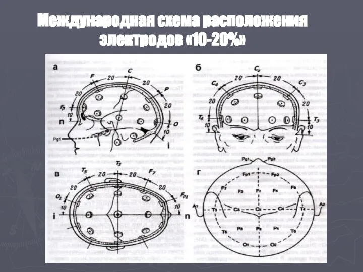 Международная схема расположения электродов «10-20%»