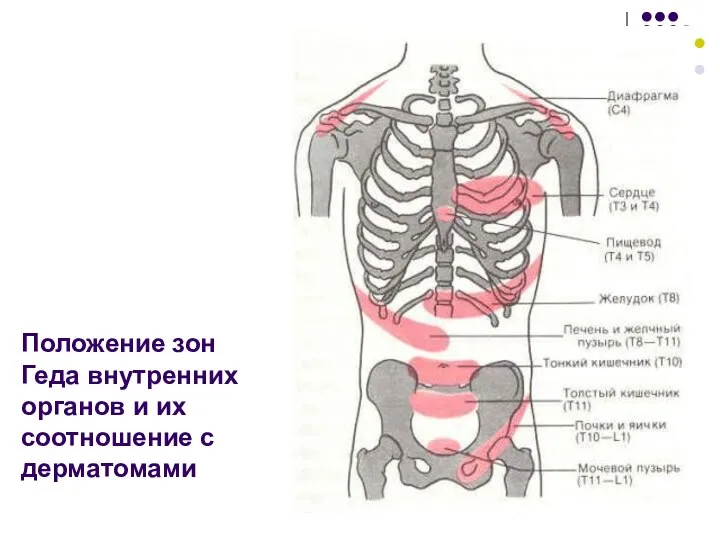 Положение зон Геда внутренних органов и их соотношение с дерматомами