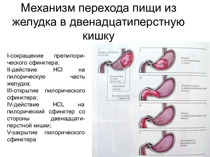 Механизм перехода пищи из желудка в двенадцатиперстную кишку I-сокращение препилори-ческого сфинктера;