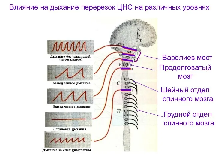 Влияние на дыхание перерезок ЦНС на различных уровнях Варолиев мост Продолговатый