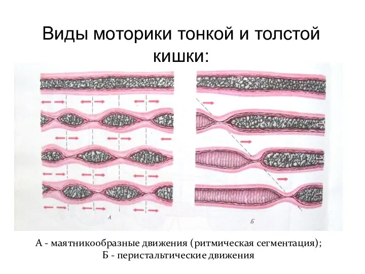 Виды моторики тонкой и толстой кишки: А - маятникообразные движения (ритмическая сегментация); Б - перистальтические движения