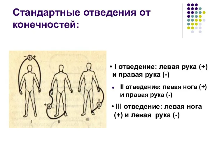 Стандартные отведения от конечностей: II отведение: левая нога (+) и правая