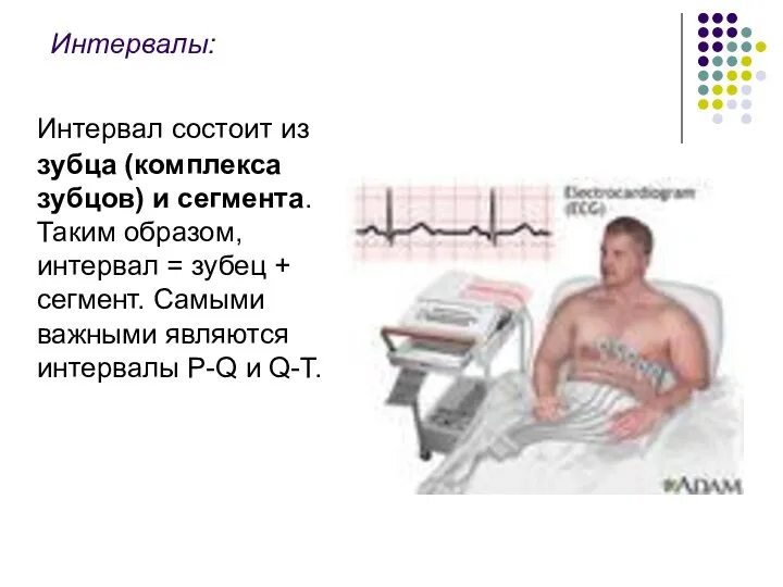 Интервалы: Интервал состоит из зубца (комплекса зубцов) и сегмента. Таким образом,