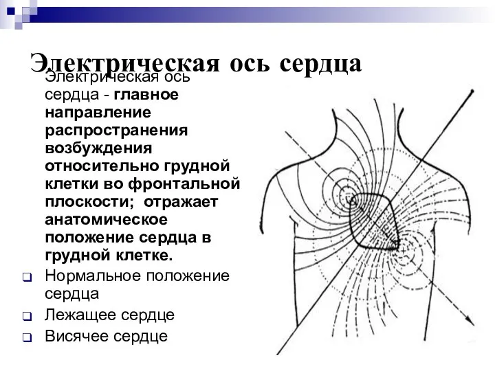 Электрическая ось сердца Электрическая ось сердца - главное направление распространения возбуждения