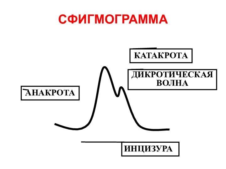 СФИГМОГРАММА АНАКРОТА КАТАКРОТА ДИКРОТИЧЕСКАЯ ВОЛНА ИНЦИЗУРА