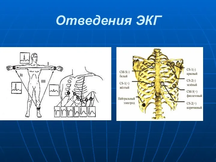 Отведения ЭКГ