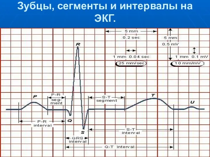 Зубцы, сегменты и интервалы на ЭКГ.