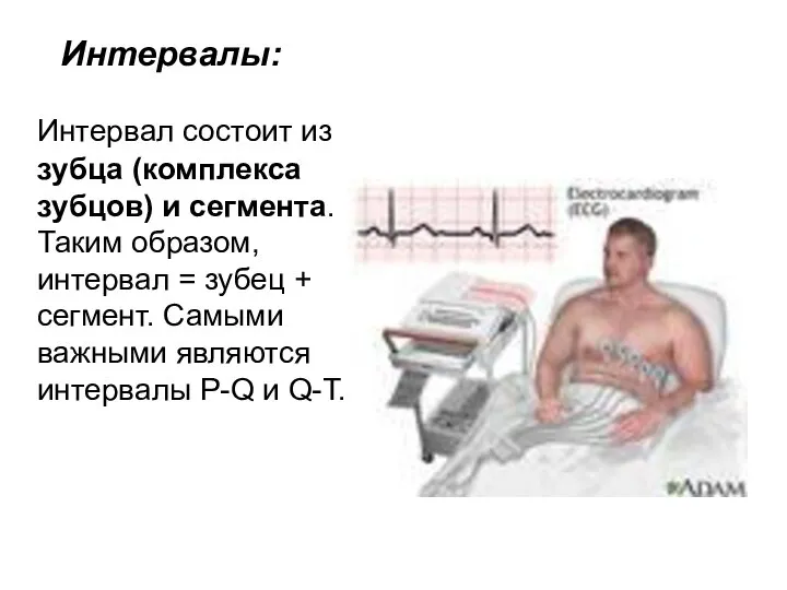 Интервалы: Интервал состоит из зубца (комплекса зубцов) и сегмента. Таким образом,