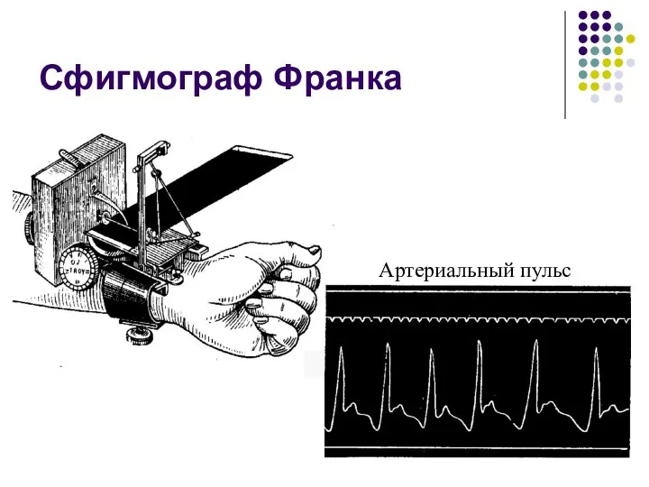 Сфигмограф Франка Сфигмограмма артериального пульса Артериальный пульс