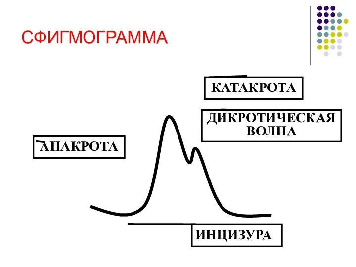 СФИГМОГРАММА АНАКРОТА КАТАКРОТА ДИКРОТИЧЕСКАЯ ВОЛНА ИНЦИЗУРА