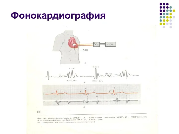 Фонокардиография