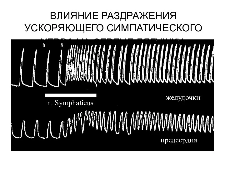 ВЛИЯНИЕ РАЗДРАЖЕНИЯ УСКОРЯЮЩЕГО СИМПАТИЧЕСКОГО НЕРВА НА СЕРДЦЕ ЛЯГУШКИ. n. Symphaticus желудочки предсердия