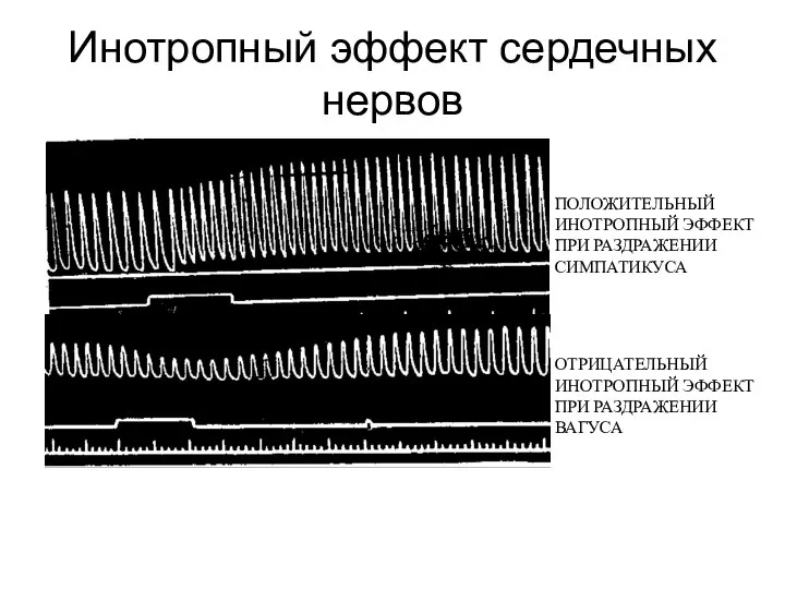 Инотропный эффект сердечных нервов ПОЛОЖИТЕЛЬНЫЙ ИНОТРОПНЫЙ ЭФФЕКТ ПРИ РАЗДРАЖЕНИИ СИМПАТИКУСА ОТРИЦАТЕЛЬНЫЙ ИНОТРОПНЫЙ ЭФФЕКТ ПРИ РАЗДРАЖЕНИИ ВАГУСА