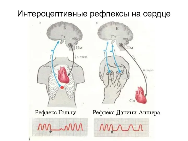 Интероцептивные рефлексы на сердце Рефлекс Гольца Рефлекс Данини-Ашнера