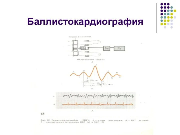 Баллистокардиография