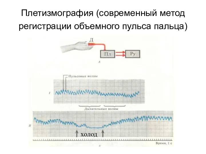 Плетизмография (современный метод регистрации объемного пульса пальца) холод