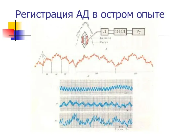 Регистрация АД в остром опыте