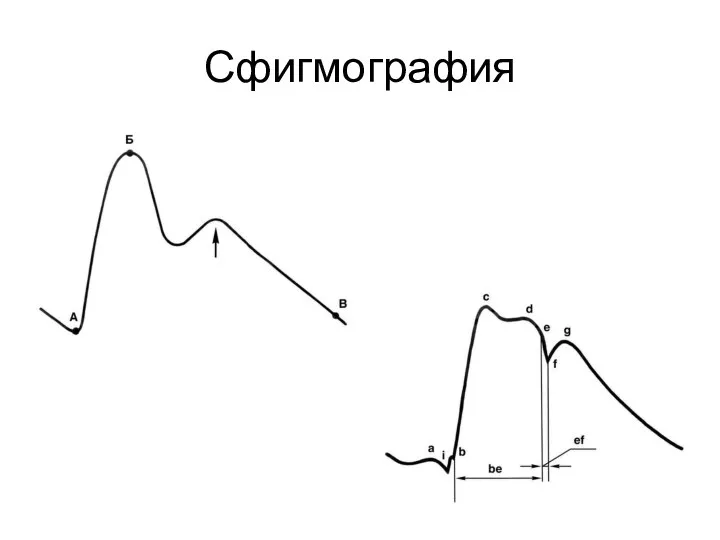 Сфигмография