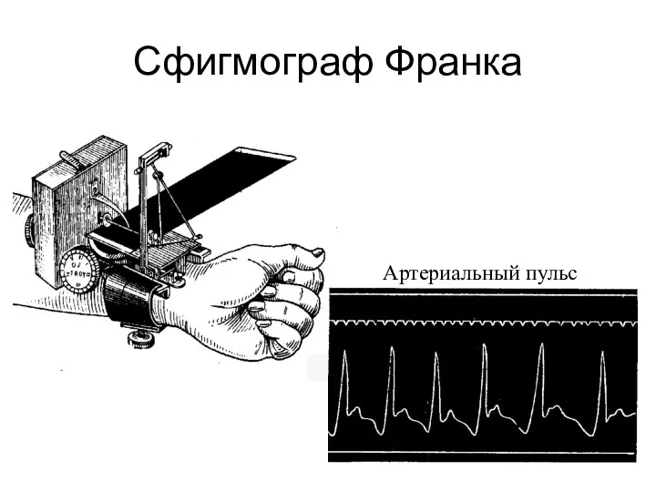 Сфигмограф Франка Сфигмограмма артериального пульса Артериальный пульс