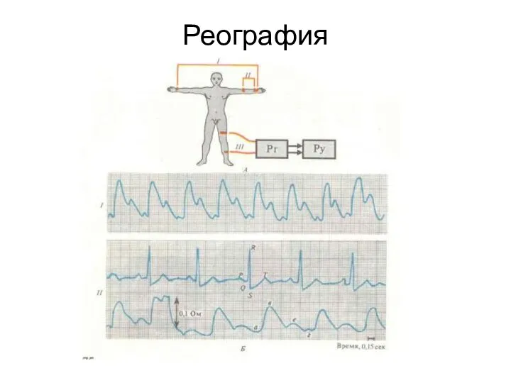 Реография