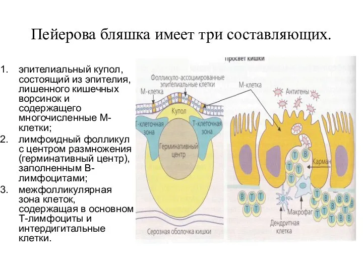 Пейерова бляшка имеет три составляющих. эпителиальный купол, состоящий из эпителия, лишенного