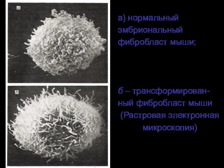а) нормальный эмбриональный фибробласт мыши; б – трансформирован- ный фибробласт мыши (Растровая электронная микроскопия)