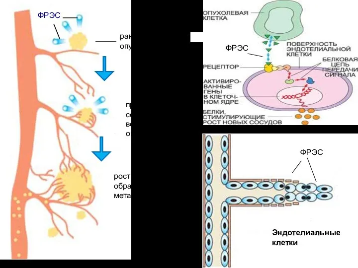 раковая опухоль ФРЭС прорастание сосудов вокруг опухоли рост опухоли и образование метастазов Эндотелиальные клетки ФРЭС ФРЭС