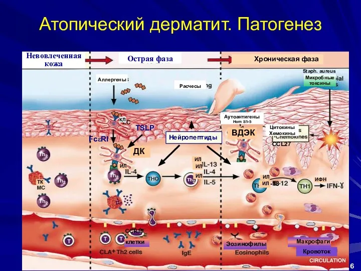 Атопический дерматит. Патогенез Leung DYM J Allergy Clin Immunol 2000;105:860–76 Staph.