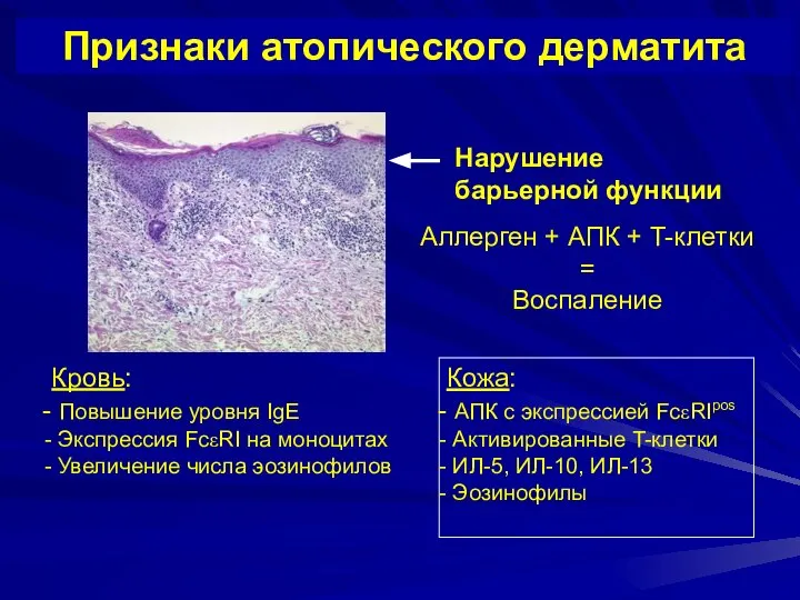 Кровь: Повышение уровня IgE Экспрессия FcεRI на моноцитах Увеличение числа эозинофилов