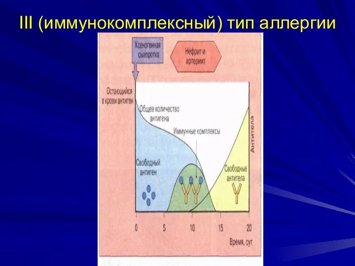 III (иммунокомплексный) тип аллергии