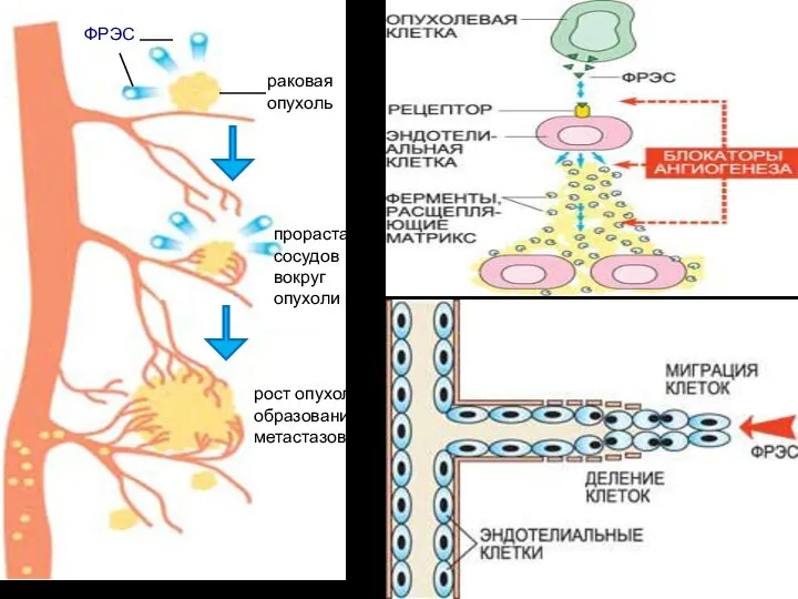 раковая опухоль ФРЭС прорастание сосудов вокруг опухоли рост опухоли и образование метастазов