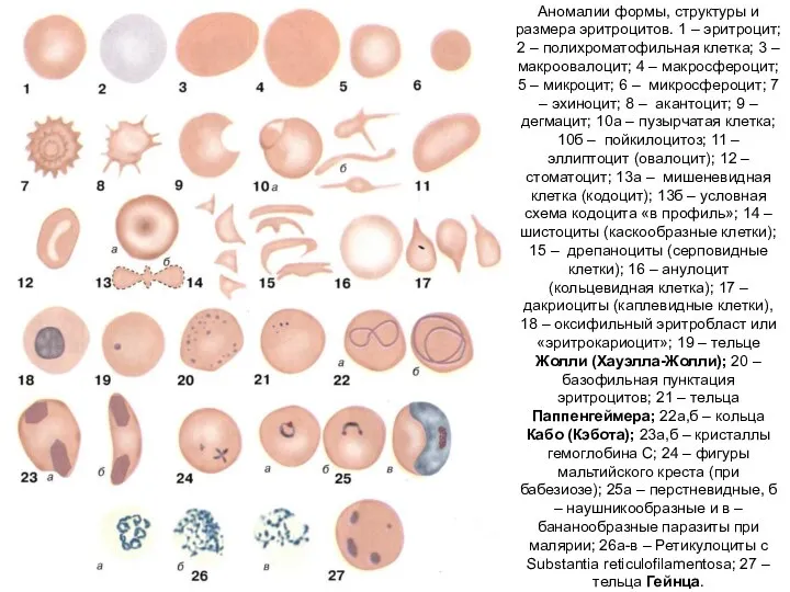 Аномалии формы, структуры и размера эритроцитов. 1 – эритроцит; 2 –