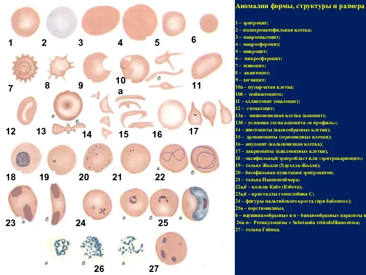 Аномалии формы, структуры и размера эритроцитов. 1 – эритроцит; 2 –