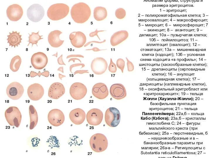 Аномалии формы, структуры и размера эритроцитов. 1 – эритроцит; 2 –