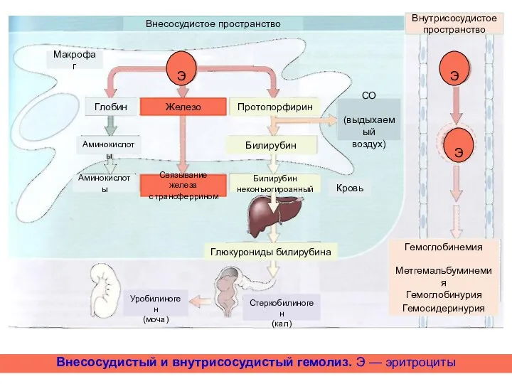Внесосудистый и внутрисосудистый гемолиз. Э — эритроциты Гемоглобинемия Метгемальбуминемия Гемоглобинурия Гемосидеринурия