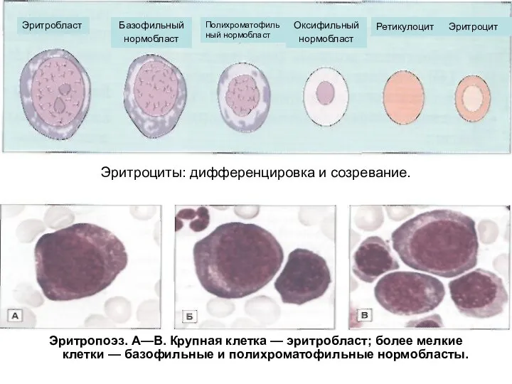 Эритроциты: дифференцировка и созревание. Эритропоэз. А—В. Крупная клетка — эритробласт; более