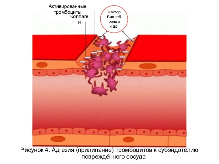 Рисунок 4. Адгезия (прилипание) тромбоцитов к субэндотелию повреждённого сосуда Активированные тромбоциты Коллаген Фактор Виллебранда и др.