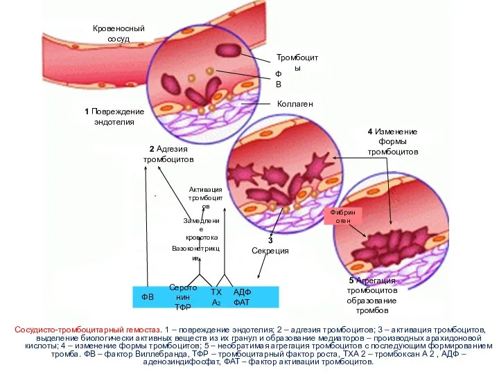 Сосудисто-тромбоцитарный гемостаз. 1 – повреждение эндотелия; 2 – адгезия тромбоцитов; 3