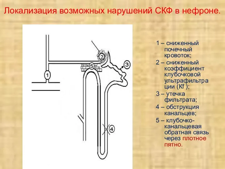 Локализация возможных нарушений СКФ в нефроне. 1 – сниженный почечный кровоток;