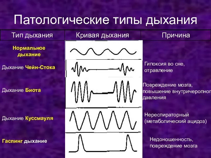 Патологические типы дыхания Нормальное дыхание Дыхание Чейн-Стока Дыхание Биота Дыхание Куссмауля