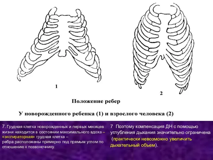 7. Грудная клетка новорожденных и первых месяцев жизни находится в состоянии