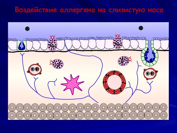 Воздействие аллергена на слизистую носа MKC