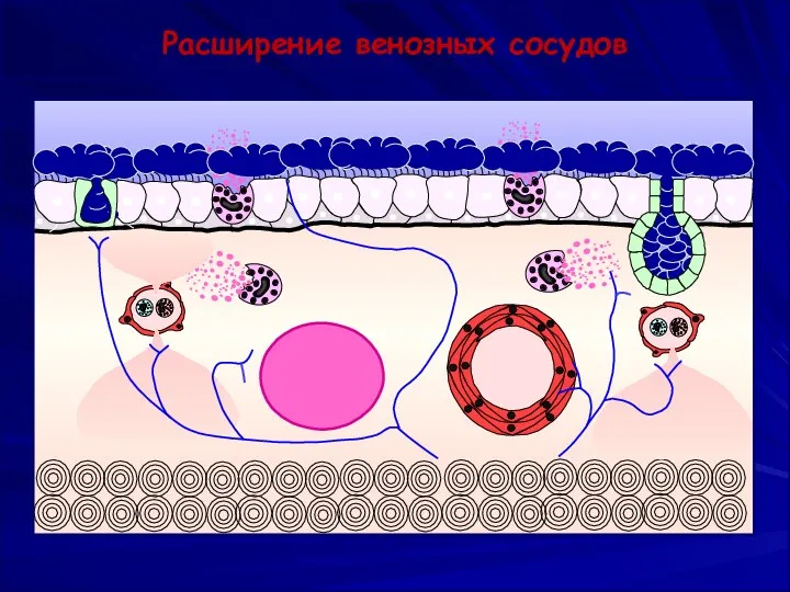 Расширение венозных сосудов