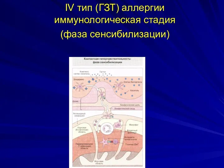 IV тип (ГЗТ) аллергии иммунологическая стадия (фаза сенсибилизации)