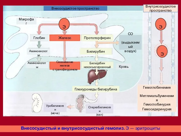Внесосудистый и внутрисосудистый гемолиз. Э — эритроциты Гемоглобинемия Метгемальбуминемия Гемоглобинурия Гемосидеринурия
