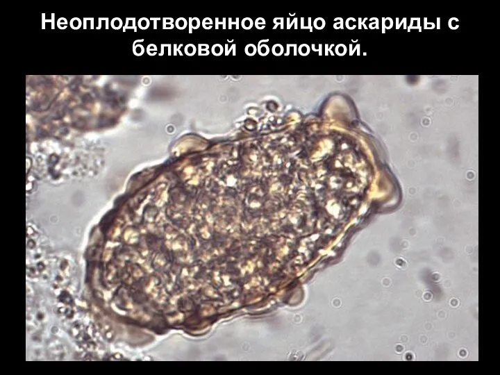 Неоплодотворенное яйцо аскариды с белковой оболочкой.