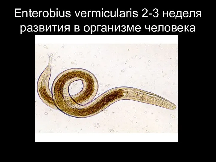 Enterobius vermicularis 2-3 неделя развития в организме человека