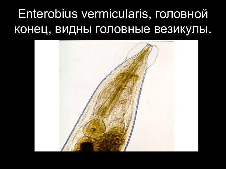Enterobius vermicularis, головной конец, видны головные везикулы.