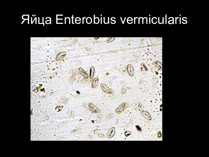 Яйца Enterobius vermicularis