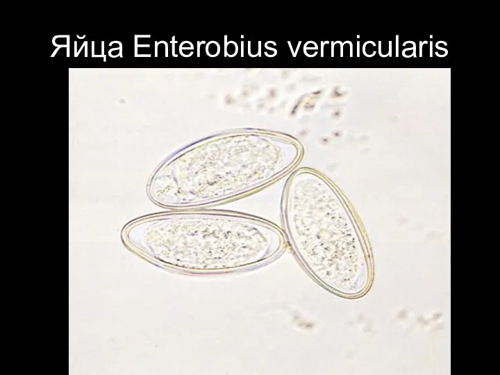 Яйца Enterobius vermicularis